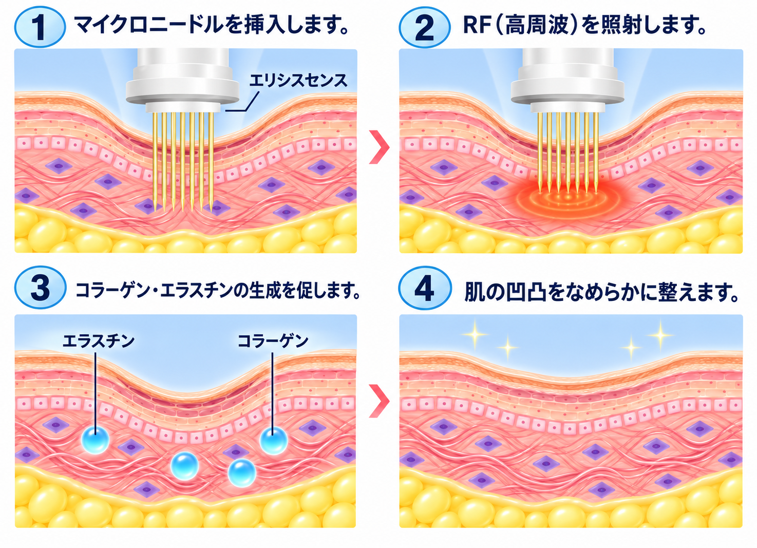 エリシスセンスが肌に作用する仕組み