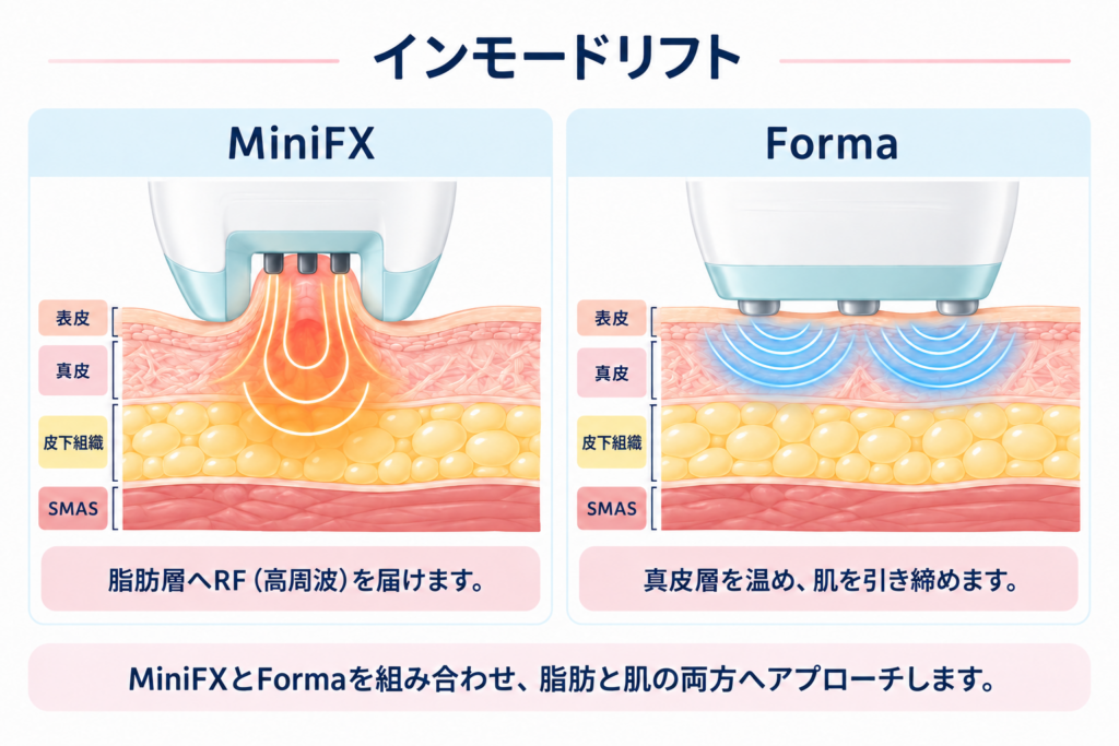 インモードリフト MiniFXとFormaの違い