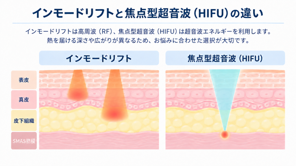 インモードリフトと焦点型超音波（HIFU）の違い