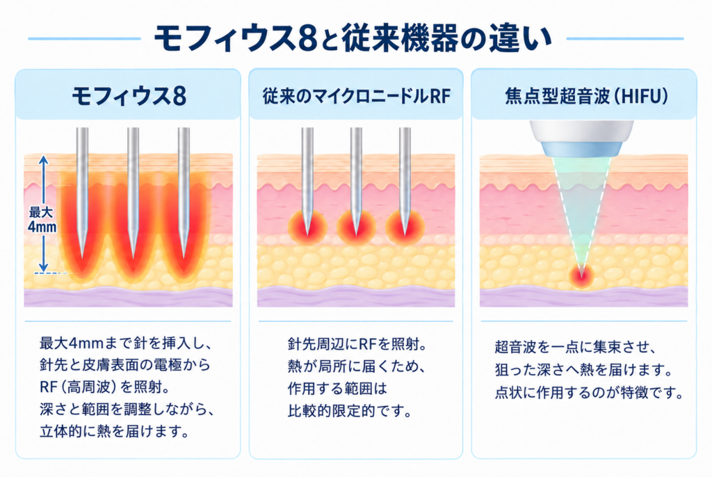 モフィウス8と従来機器の違い